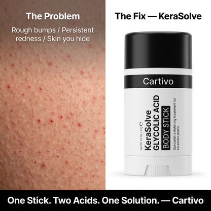 Cartivo KeraSolve™ Body Stick
